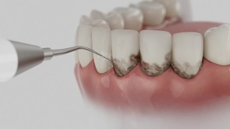 Trusted Dental Crowns And Bridges service in Thomasville, AL - Dentist Open Now